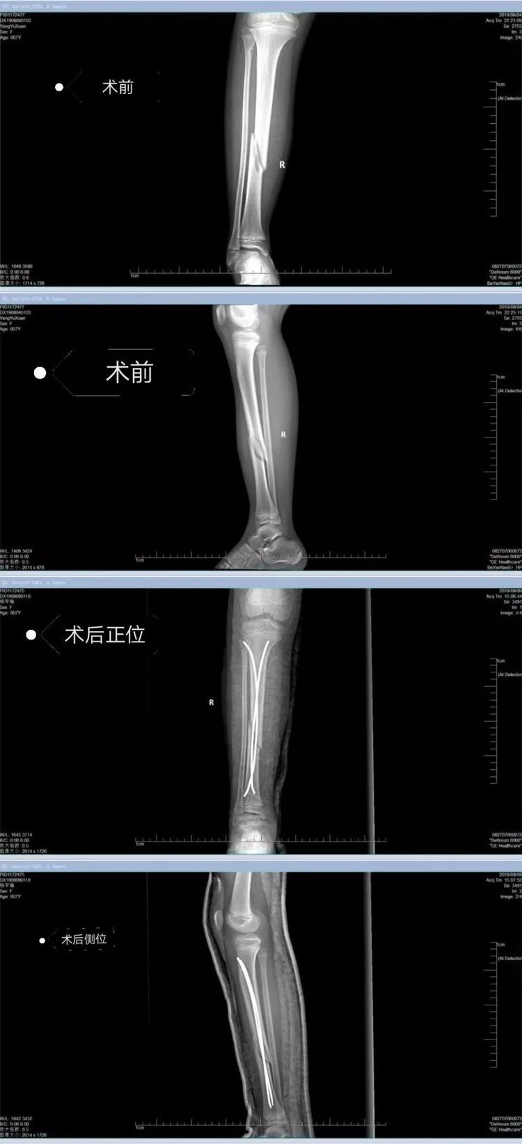 傘頭和他的女人 视频截图