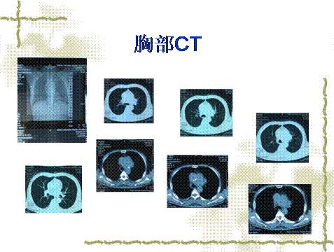 以青春之名 产品图片