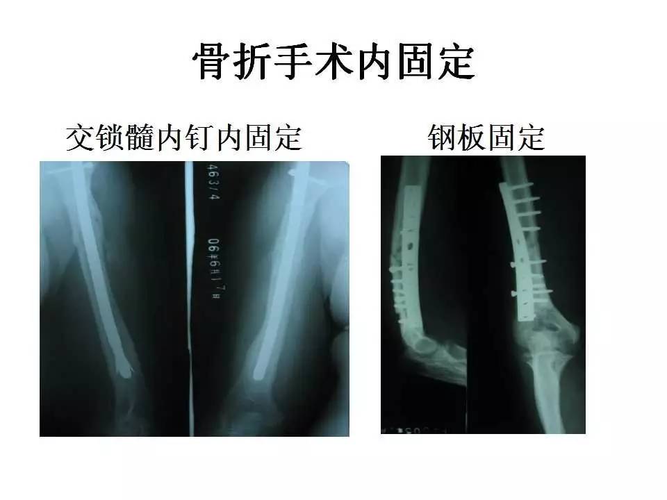 你瞅啥？外星人 视频截图