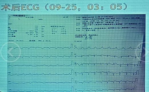 衝出康普頓 视频截图