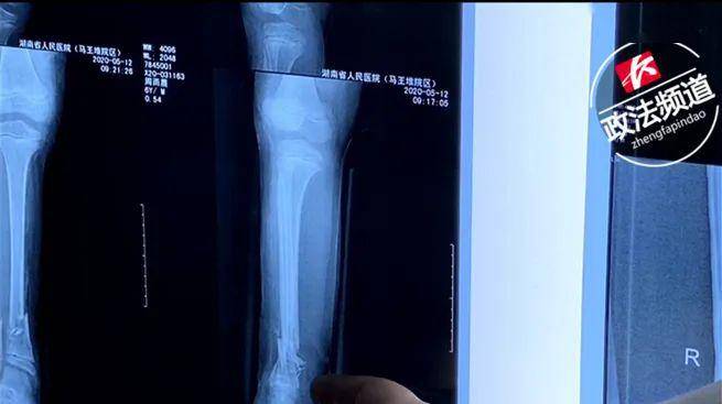 再造初戀 视频截图